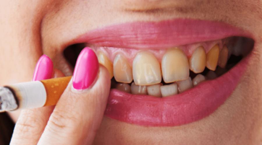 Желтые зубы курильщика: отчего так бывает и что с этим делать?